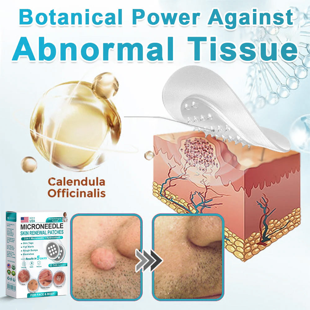 Hiskin ® 2-in-1 Microneedle & Hydrocolloid Patch👨⚕️ | Removes raised moles, acne, flat warts, and skin tags | Helps improve wrinkles, scars, and blemishes | Invisible patches for face and body